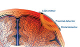 OXIMETRÍA CEREBRAL / SOMÁTICA Sistema INVOS ™ 7100