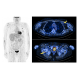 Escáner Molecular Vereos PET/CT Digital Philips