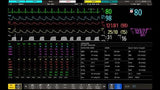 IntelliVue MX800