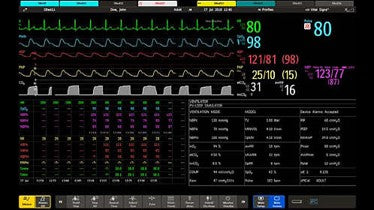 IntelliVue MX800