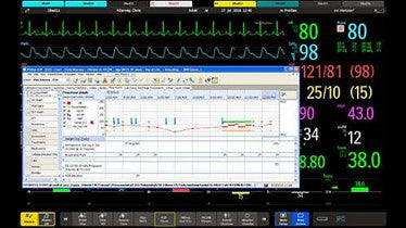 IntelliVue MX800