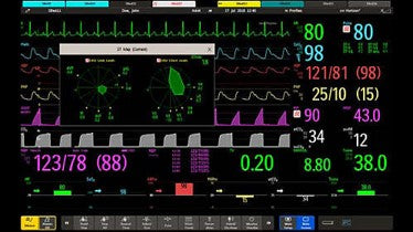 IntelliVue MX800