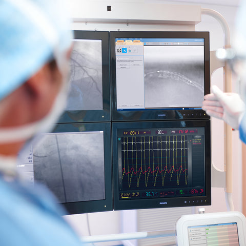 Software para intervención StentBoost Visualización mejorada