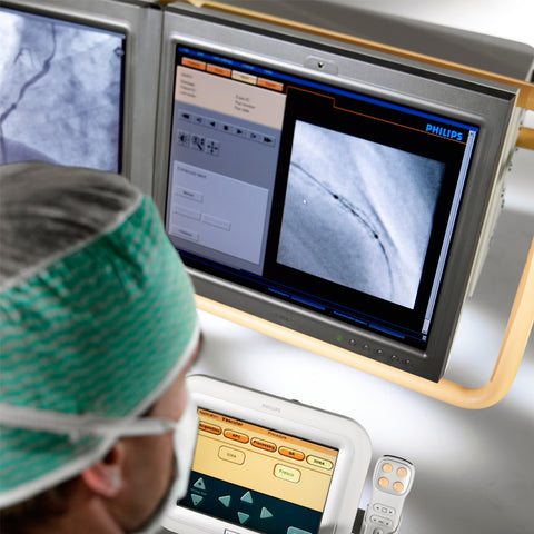 Software para intervención StentBoost Visualización mejorada