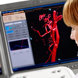 Software de análisis de rayos X Allura 3D -RA